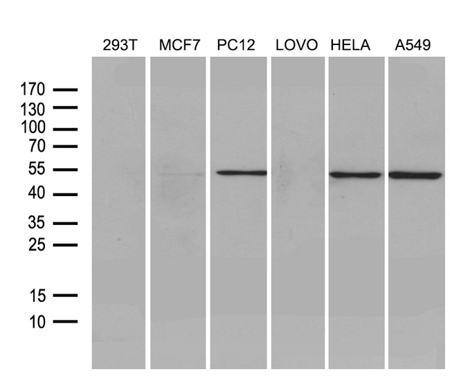 FSCN1 / Fascin Antibody - Western blot analysis of extracts. (35ug) from 6 different cell lines by using anti-FSCN1 monoclonal antibody. (1:500)