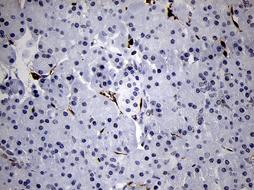 FSCN1 / Fascin Antibody - Immunohistochemical staining of paraffin-embedded Human pancreas tissue within the normal limits using anti-FSCN1 mouse monoclonal antibody. (Heat-induced epitope retrieval by 1mM EDTA in 10mM Tris buffer. (pH8.5) at 120°C for 3 min. (1:500)