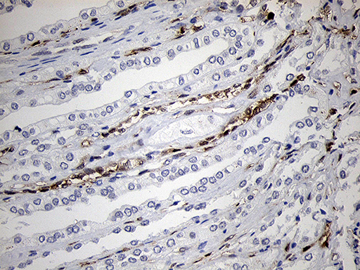 FSCN1 / Fascin Antibody - Immunohistochemical staining of paraffin-embedded Human Kidney tissue within the normal limits using anti-FSCN1 mouse monoclonal antibody. (Heat-induced epitope retrieval by 1mM EDTA in 10mM Tris buffer. (pH8.5) at 120°C for 3 min. (1:500)