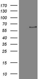 FSCN1 / Fascin Antibody - HEK293T cells were transfected with the pCMV6-ENTRY control. (Left lane) or pCMV6-ENTRY FSCN1. (Right lane) cDNA for 48 hrs and lysed. Equivalent amounts of cell lysates. (5 ug per lane) were separated by SDS-PAGE and immunoblotted with anti-FSCN1. (1:2000)
