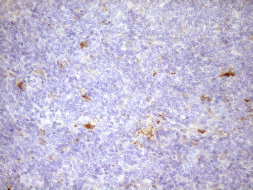 FSCN1 / Fascin Antibody - Immunohistochemical staining of paraffin-embedded Human lymph node tissue within the normal limits using anti-FSCN1 mouse monoclonal antibody. (Heat-induced epitope retrieval by Tris-EDTA, pH8.0)(1:150)