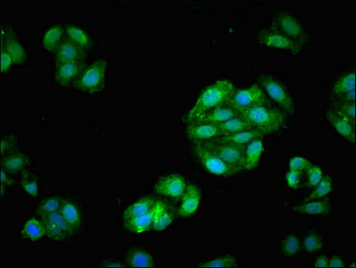 FSCN1 / Fascin Antibody - Immunofluorescent analysis of HepG2 cells at a dilution of 1:100 and Alexa Fluor 488-congugated AffiniPure Goat Anti-Rabbit IgG(H+L)