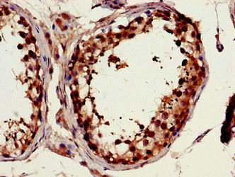 FSCN1 / Fascin Antibody - Immunohistochemistry image of paraffin-embedded human testis tissue at a dilution of 1:100