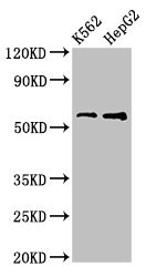 FSCN1 / Fascin Antibody - Positive Western Blot detected in K562 whole cell lysate, HepG2 whole cell lysate. All lanes: FSCN1 antibody at 3.2 µg/ml Secondary Goat polyclonal to rabbit IgG at 1/50000 dilution. Predicted band size: 55 KDa. Observed band size: 55 KDa