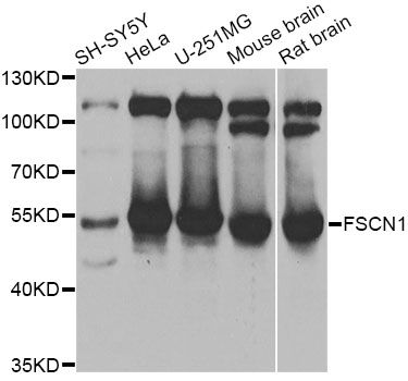 FSCN1 / Fascin Antibody - Western blot analysis of extracts of various cell lines, using FSCN1 antibody at 1:1000 dilution. The secondary antibody used was an HRP Goat Anti-Rabbit IgG (H+L) at 1:10000 dilution. Lysates were loaded 25ug per lane and 3% nonfat dry milk in TBST was used for blocking. An ECL Kit was used for detection and the exposure time was 3s.