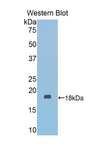 FSCN2 / Retinal Fascin Antibody - Western blot of recombinant FSCN2 / Retinal Fascin.  This image was taken for the unconjugated form of this product. Other forms have not been tested.