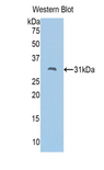 FSCN2 / Retinal Fascin Antibody - Western blot of recombinant FSCN2 / Retinal Fascin.  This image was taken for the unconjugated form of this product. Other forms have not been tested.