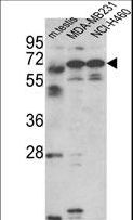 FSCN3 Antibody - Western blot of Fascin-3 Antibody in MDA-MB231, NCI-H460 cell line and mouse testis tissue lysates (35 ug/lane). Fascin-3 (arrow) was detected using the purified antibody.
