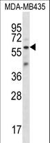 FSCN3 Antibody - FSCN3 Antibody western blot of MDA-MB435 cell line lysates (35 ug/lane). The FSCN3 antibody detected the FSCN3 protein (arrow).