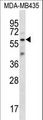 FSCN3 Antibody - FSCN3 Antibody western blot of MDA-MB435 cell line lysates (35 ug/lane). The FSCN3 antibody detected the FSCN3 protein (arrow).