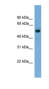 FSCN3 Antibody - FSCN3 antibody Western blot of Fetal Muscle lysate. This image was taken for the unconjugated form of this product. Other forms have not been tested.