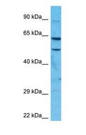 FSD1 Antibody - Western blot of FSD1 Antibody with human 721_B Whole Cell lysate.  This image was taken for the unconjugated form of this product. Other forms have not been tested.