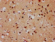 FSD1 Antibody - Immunohistochemistry Dilution at 1:500 and staining in paraffin-embedded human brain tissue performed on a Leica BondTM system. After dewaxing and hydration, antigen retrieval was mediated by high pressure in a citrate buffer (pH 6.0). Section was blocked with 10% normal Goat serum 30min at RT. Then primary antibody (1% BSA) was incubated at 4°C overnight. The primary is detected by a biotinylated Secondary antibody and visualized using an HRP conjugated SP system.