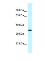 FSD1L Antibody - Western blot of Human COLO205. FSD1L antibody dilution 1.0 ug/ml.  This image was taken for the unconjugated form of this product. Other forms have not been tested.