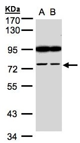 FSD2 Antibody - Sample (30 ug whole cell lysate). A: H1299, B: HeLa S3. 7.5% SDS PAGE. FSD2 antibody diluted at 1:1000