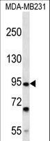 FSD2 Antibody - FSD2 Antibody western blot of MDA-MB231 cell line lysates (35 ug/lane). The FSD2 antibody detected the FSD2 protein (arrow).