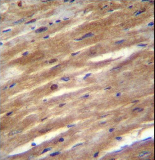 FSD2 Antibody - FSD2 Antibody immunohistochemistry of formalin-fixed and paraffin-embedded mouse heart tissue followed by peroxidase-conjugated secondary antibody and DAB staining.