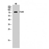 FSH Receptor / FSHR Antibody - Western blot of FSHR antibody