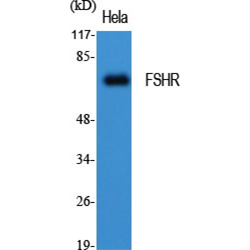 FSH Receptor / FSHR Antibody - Western blot of FSHR antibody