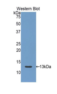 FSH Receptor / FSHR Antibody - Western blot of recombinant FSH Receptor / FSHR.  This image was taken for the unconjugated form of this product. Other forms have not been tested.