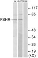 FSH Receptor / FSHR Antibody - Western blot analysis of lysates from Jurkat and HUVEC cells, using FSHR Antibody. The lane on the right is blocked with the synthesized peptide.