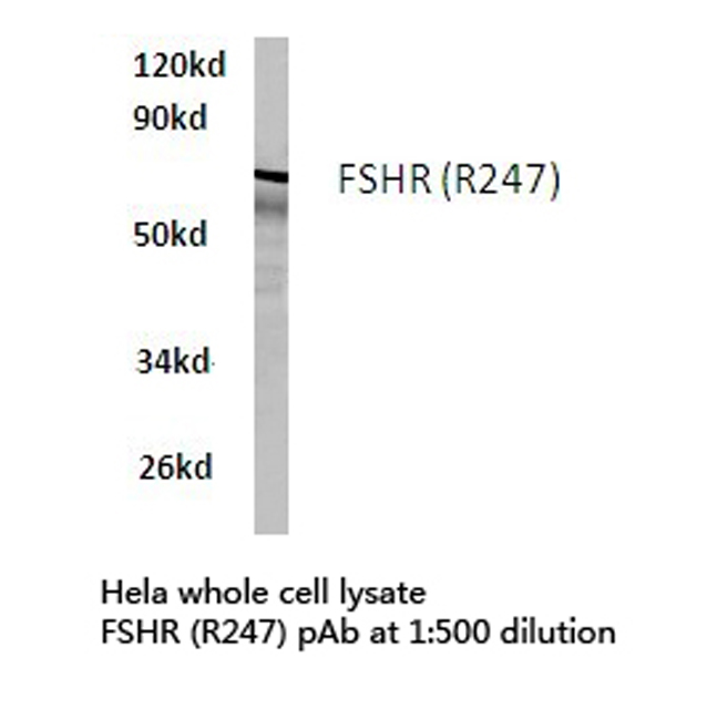 FSH Receptor / FSHR Antibody - Western blot of FSHR (R247) pAb in extracts from HeLa cells.