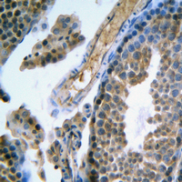 FSH Receptor / FSHR Antibody - Immunohistochemical analysis of FSHR staining in human testis formalin fixed paraffin embedded tissue section. The section was pre-treated using heat mediated antigen retrieval with sodium citrate buffer (pH 6.0). The section was then incubated with the antibody at room temperature and detected using an HRP conjugated compact polymer system. DAB was used as the chromogen. The section was then counterstained with hematoxylin and mounted with DPX.