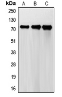 FSH Receptor / FSHR Antibody - Western blot analysis of FSHR expression in HeLa (A); A431 (B); H1299 (C) whole cell lysates.