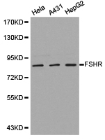 FSH Receptor / FSHR Antibody - Western blot of extracts of various cell lines, using FSHR antibody.