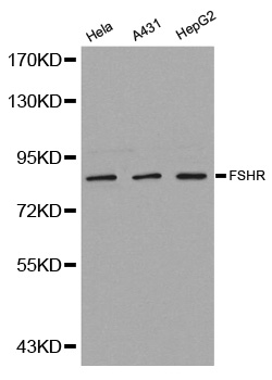FSH Receptor / FSHR Antibody - Western blot analysis of extracts of various cell lines, using FSHR antibody.
