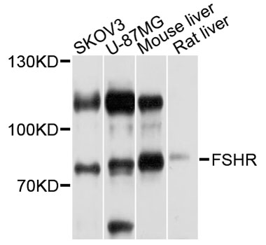FSH Receptor / FSHR Antibody - Western blot analysis of extracts of various cell lines, using FSHR antibody at 1:1000 dilution. The secondary antibody used was an HRP Goat Anti-Rabbit IgG (H+L) at 1:10000 dilution. Lysates were loaded 25ug per lane and 3% nonfat dry milk in TBST was used for blocking. An ECL Kit was used for detection and the exposure time was 20s.