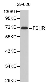 FSH Receptor / FSHR Antibody - Western blot analysis of extracts of Sw626 cell line,using FSHR antibody.