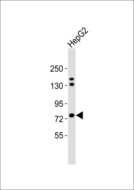 FSH Receptor / FSHR Antibody - Anti-FSHR Antibody at 1:1000 dilution + HepG2 whole cell lysates Lysates/proteins at 20 ug per lane. Secondary Goat Anti-Rabbit IgG, (H+L),Peroxidase conjugated at 1/10000 dilution Predicted band size : 78 kDa Blocking/Dilution buffer: 5% NFDM/TBST.