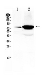 FSH Receptor / FSHR Antibody - Western blot - Anti-FSH Receptor Picoband Antibody