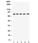 FSH Receptor / FSHR Antibody - Western blot testing of 1) rat testis, 2) rat ovary, 3) mouse testis, 4) mouse ovary and 5) human HeLa lysate with FSH Receptor antibody at 0.5ug/ml. Predicted/observed molecular weight: ~78 kDa.