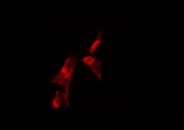 FSH Receptor / FSHR Antibody - Staining HuvEc cells by IF/ICC. The samples were fixed with PFA and permeabilized in 0.1% Triton X-100, then blocked in 10% serum for 45 min at 25°C. The primary antibody was diluted at 1:200 and incubated with the sample for 1 hour at 37°C. An Alexa Fluor 594 conjugated goat anti-rabbit IgG (H+L) Ab, diluted at 1/600, was used as the secondary antibody.