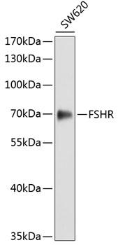 FSH Receptor / FSHR Antibody - Western blot analysis of extracts of SW620 cells using FSHR Polyclonal Antibody.