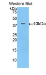 FSHB / FSH Beta Antibody - Western blot of recombinant FSHB / FSH Beta.  This image was taken for the unconjugated form of this product. Other forms have not been tested.
