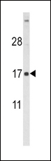 FSHB / FSH Beta Antibody - Western blot of FSHB Antibody (Center T70) in HL60 cell line lysates (35 ug/lane). FSHB (arrow) was detected using the purified antibody.