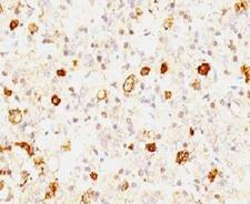 FSHB / FSH Beta Antibody - Formalin-fixed, paraffin-embedded human pituitary stained with FSH-beta antibody (FSHb/1062).  This image was taken for the unmodified form of this product. Other forms have not been tested.