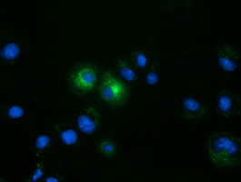 FSHB / FSH Beta Antibody - Anti-FSHB mouse monoclonal antibody  immunofluorescent staining of COS7 cells transiently transfected by pCMV6-ENTRY FSHB.