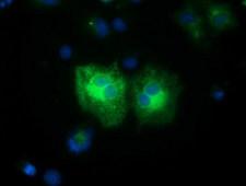 FSHB / FSH Beta Antibody - Anti-FSHB mouse monoclonal antibody  immunofluorescent staining of COS7 cells transiently transfected by pCMV6-ENTRY FSHB.
