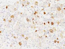 FSHB / FSH Beta Antibody - Formalin-fixed, paraffin-embedded human pituitary stained with FSH-beta antibody (SPM107).  This image was taken for the unmodified form of this product. Other forms have not been tested.