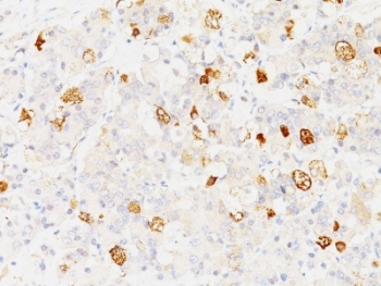 FSHB / FSH Beta Antibody - Formalin-fixed, paraffin-embedded human pituitary stained with FSH-beta antibody (SPM107).  This image was taken for the unmodified form of this product. Other forms have not been tested.