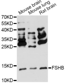 FSHB / FSH Beta Antibody - Western blot analysis of extracts of various cell lines, using FSHB antibody at 1:3000 dilution. The secondary antibody used was an HRP Goat Anti-Rabbit IgG (H+L) at 1:10000 dilution. Lysates were loaded 25ug per lane and 3% nonfat dry milk in TBST was used for blocking. An ECL Kit was used for detection and the exposure time was 90s.