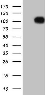 FSIP1 Antibody - HEK293T cells were transfected with the pCMV6-ENTRY control. (Left lane) or pCMV6-ENTRY FSIP1. (Right lane) cDNA for 48 hrs and lysed. Equivalent amounts of cell lysates. (5 ug per lane) were separated by SDS-PAGE and immunoblotted with anti-FSIP1.