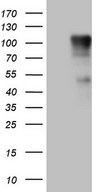 FSIP1 Antibody - HEK293T cells were transfected with the pCMV6-ENTRY control. (Left lane) or pCMV6-ENTRY FSIP1. (Right lane) cDNA for 48 hrs and lysed. Equivalent amounts of cell lysates. (5 ug per lane) were separated by SDS-PAGE and immunoblotted with anti-FSIP1.