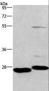 FSP27 / CIDEC Antibody - Western blot analysis of Mouse intestinum tenue and heart tissue, using CIDEC Polyclonal Antibody at dilution of 1:551.