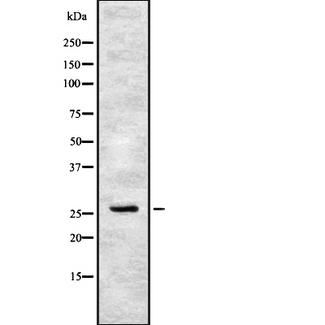 FSP27 / CIDEC Antibody - Western blot analysis of CIDEC using HeLa whole cells lysates