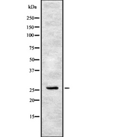 FSP27 / CIDEC Antibody - Western blot analysis of CIDEC using HeLa whole cells lysates